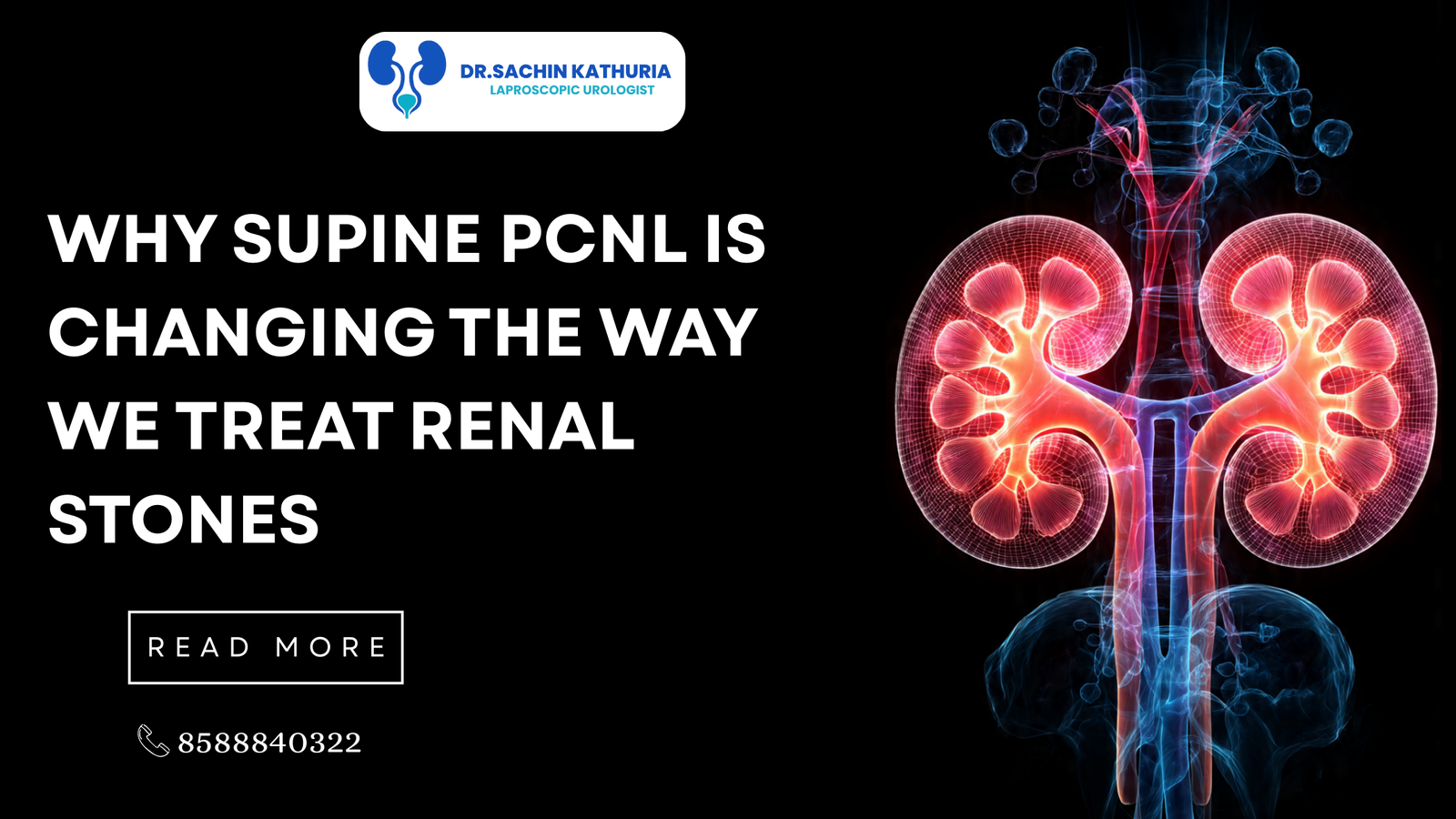 Why SUPINE PCNL Is Changing the Way We Treat Renal Stones