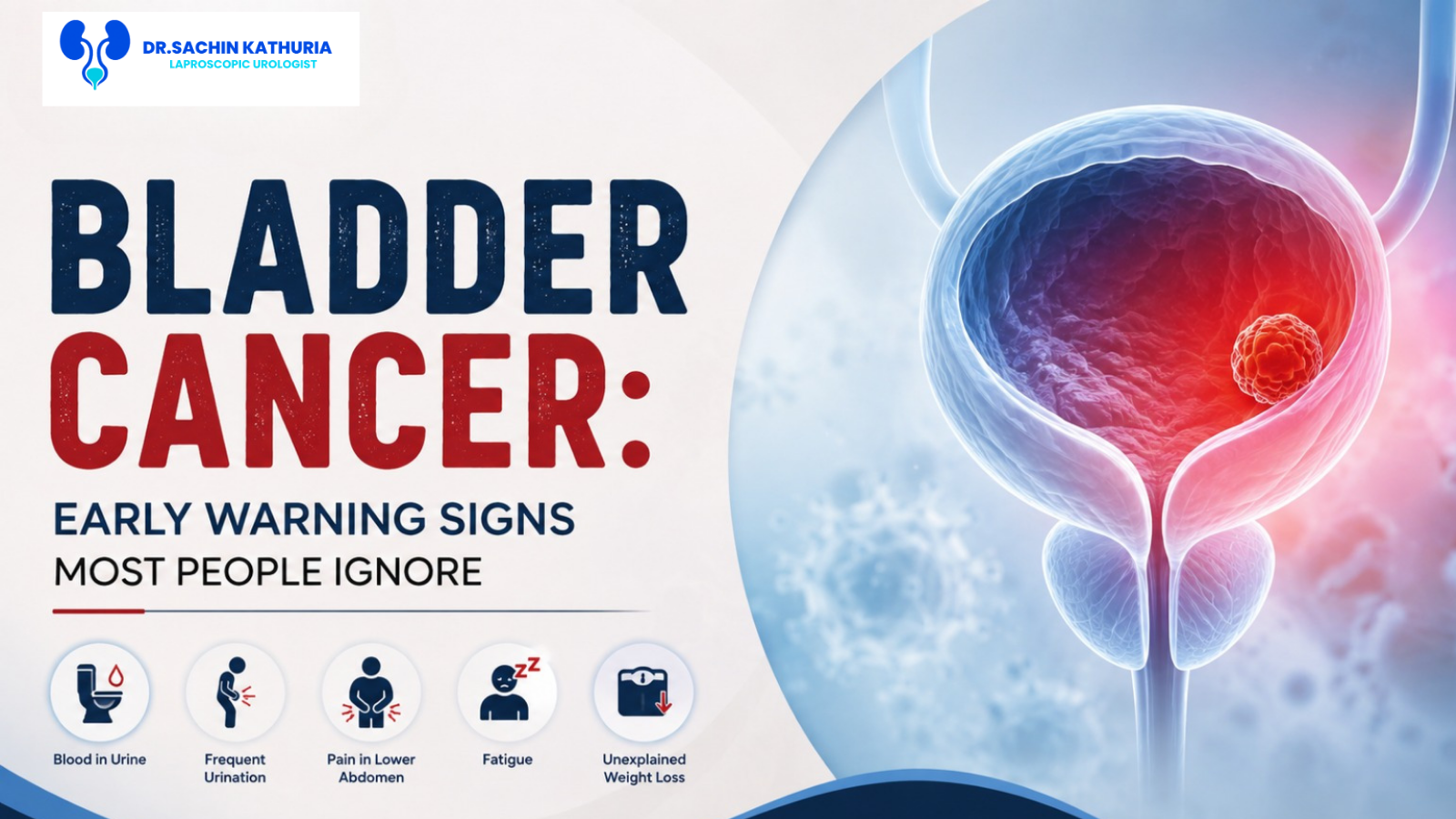 Bladder Cancer: Early Warning Signs Most People Ignore