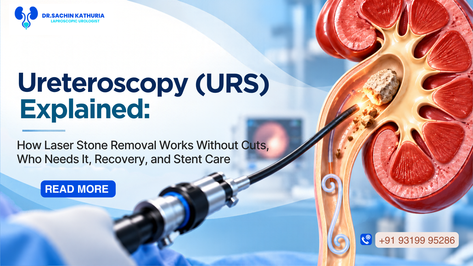 Illustration showing a thin scope reaching a stone in the urinary tract