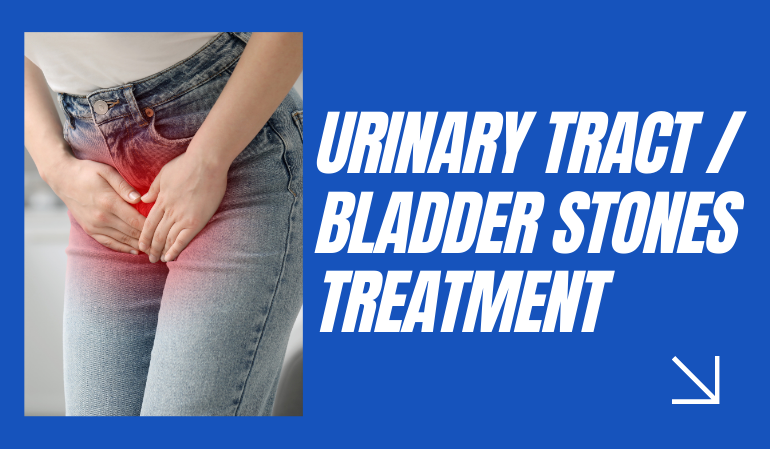 Urinary Tract / Bladder Stones Treatment