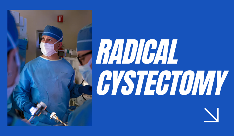 Radical Cystectomy